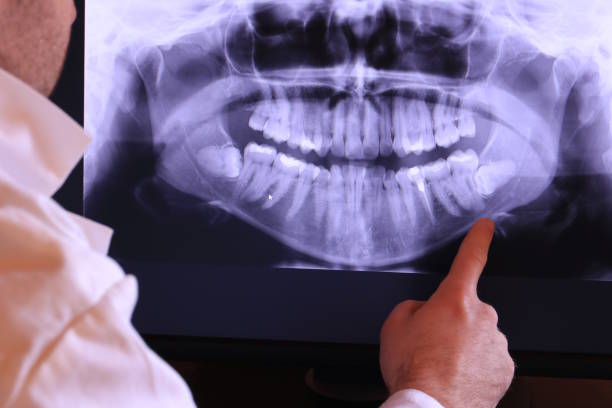 Best Emergency Denture Repair in Cayuga, IN