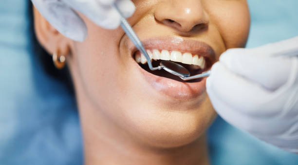 Best Broken or Chipped Tooth Repair in Cayuga, IN